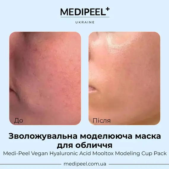 Medi-Peel Vegan Hyaluronic Acid Mooltox Modeling Cup Pack
