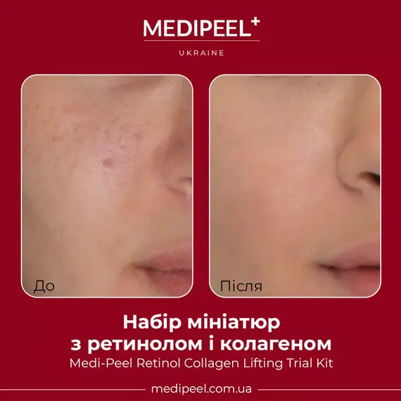 Medi-Peel Retinol Collagen Lifting Trial Kit