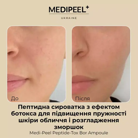 Medi Peel Peptide-Tox Bor Ampoule (Bor-Tox Peptide Ampoule)