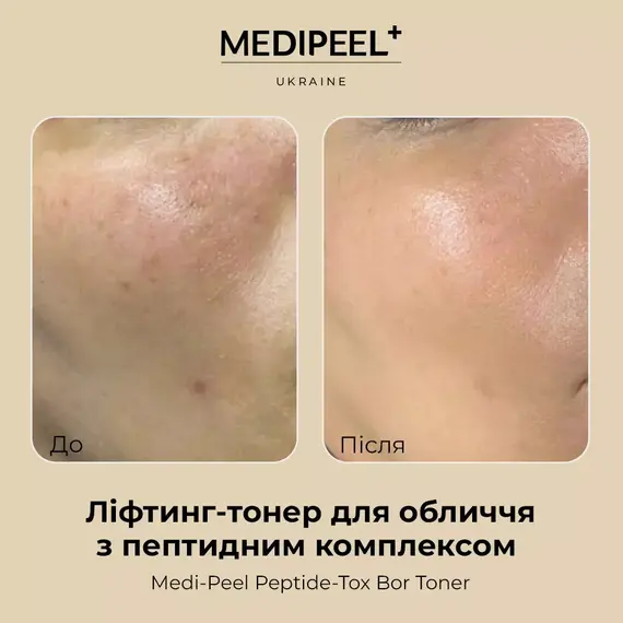 Medi-Peel Peptide-Tox Bor Toner (Bor-Tox Peptide Toner)
