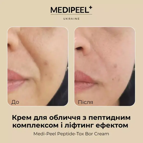 Medi-Peel Bor-Tox Cream
