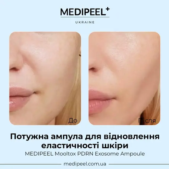 MEDIPEEL Mooltox PDRN Exosome Ampoule