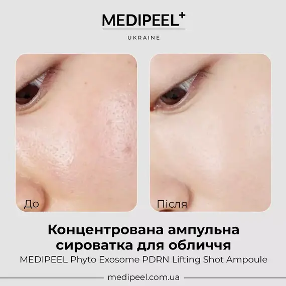 MEDIPEEL Phyto Exosome PDRN Lifting Shot Ampoule