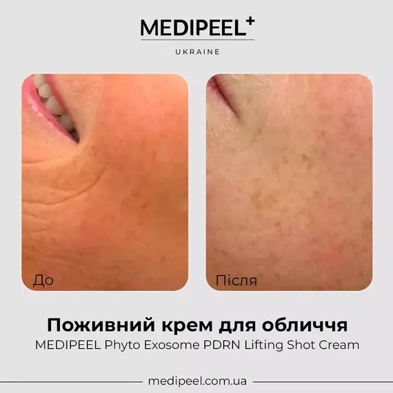 MEDIPEEL Phyto Exosome PDRN Lifting Shot Cream