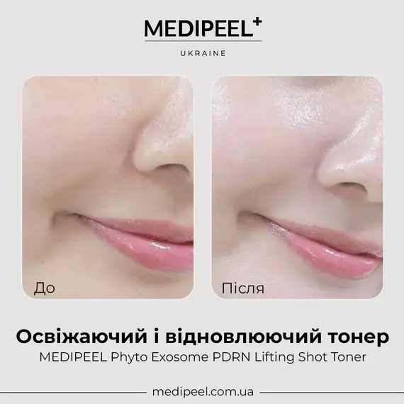 MEDIPEEL Phyto Exosome PDRN Lifting Shot Toner