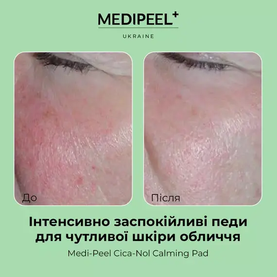 Cica-Nol Calming Pad