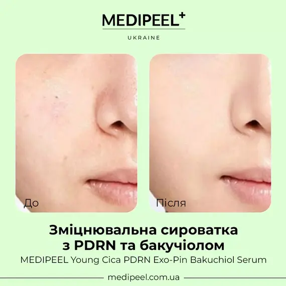 Young Cica PDRN Exo-Pin Bakuchiol Serum