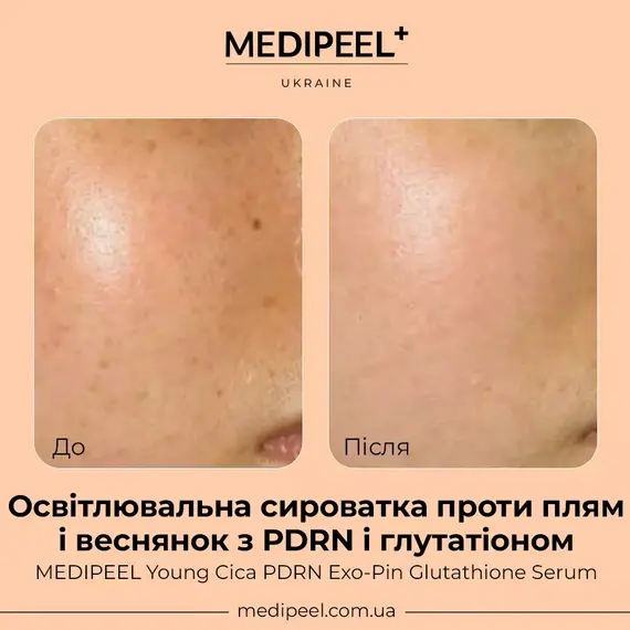 Young Cica PDRN Exo-Pin Glutathione Serum