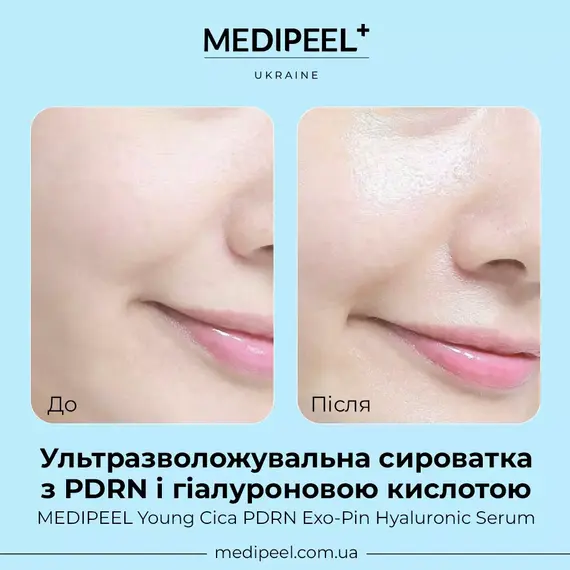 Young Cica PDRN Exo-Pin Hyaluronic Serum