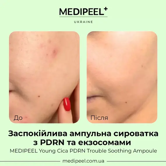 Young Cica PDRN Trouble Soothing Ampoule