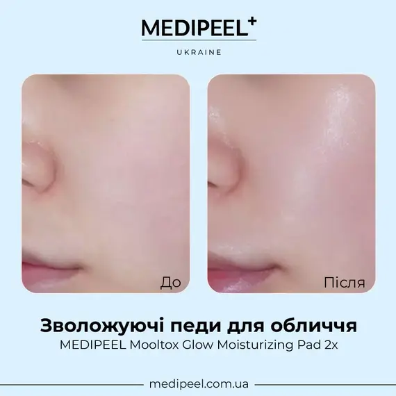 MEDIPEEL Mooltox Glow Moisturizing Pad 2x