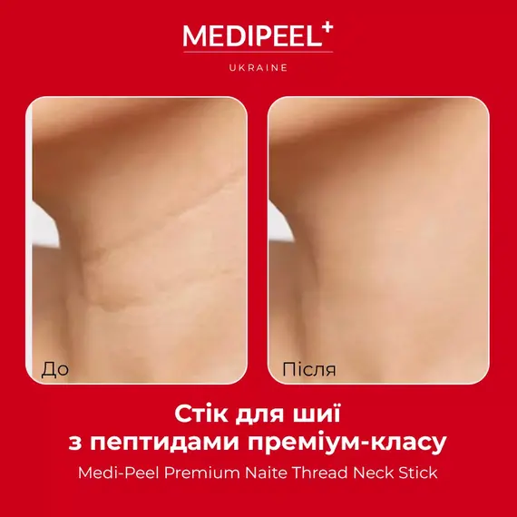 MEDIPEEL Naite Neck Care Duo